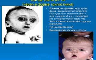 Синдром апера до и после