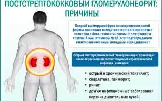 Отеки при нефротическом синдроме остром гломерулонефрите