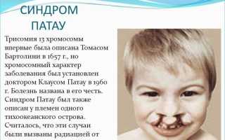 Синдром трисомии 13 хромосомы синдром патау его цитогенетические варианты