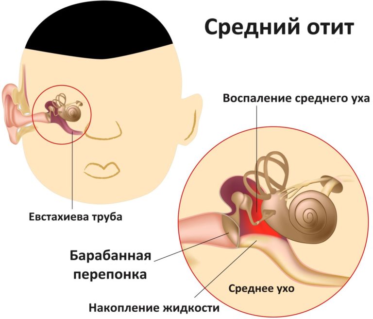 Как лечить височно челюстной синдром