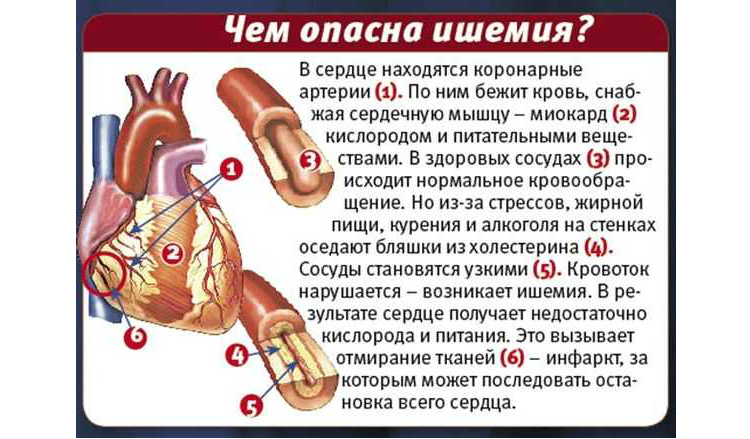 Чем опасна ишемия