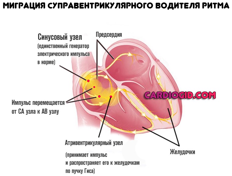 Миграция суправентрикулярного водителя ритма