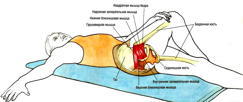 Синдром грушевидной мышцы лечение в домашних