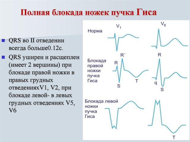 Инфографика 1