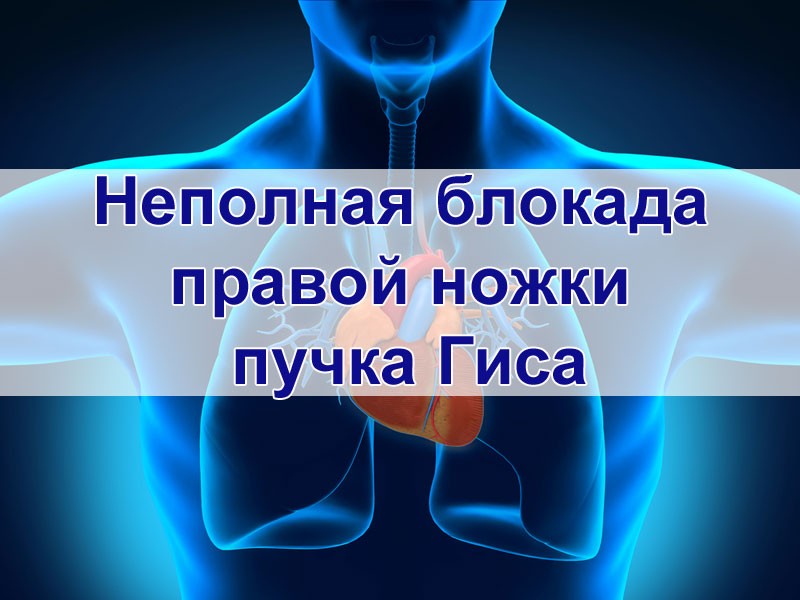Неполная блокада правой ножки пучка Гиса