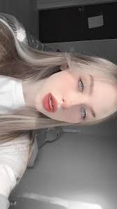 Симптоматика болезни Как проявляется синдром дауна