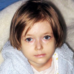 Причины болезни бабочки