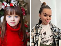 Признаки синдрома дауна Тип заболевания