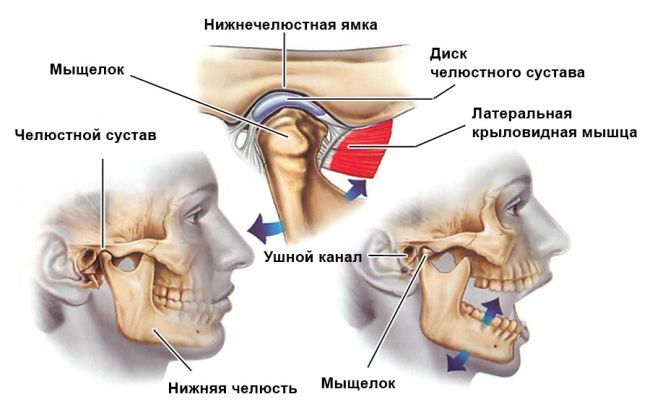 Как лечить височно челюстной синдром