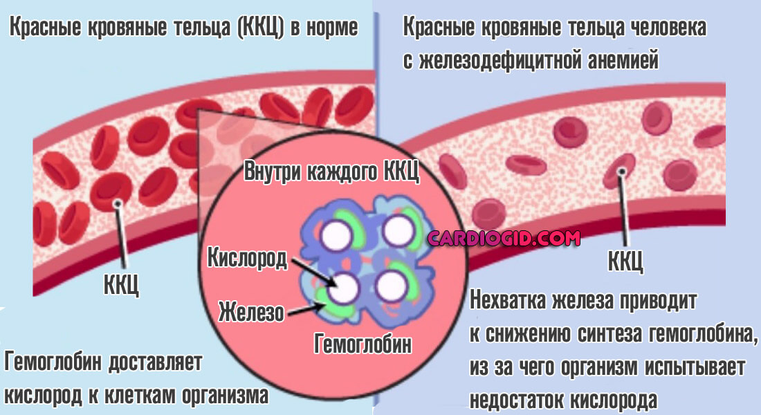 жда